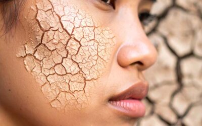 Winter Skin Woes? Omega-3 to the Rescue!