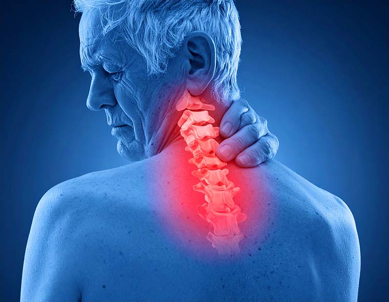 WHEN STREAMING BECOMES A REAL PAIN IN THE NECK