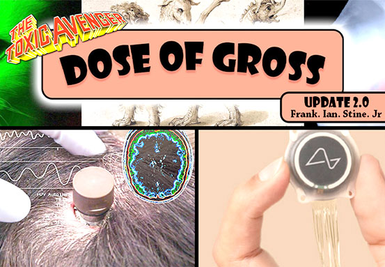 Dose of Gross May 2026